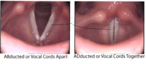 Epiglottis opening (right side) and closing (left side)